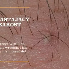 Gęstnienie zarostu: Wiek, geny, hormony co musisz wiedzieć?