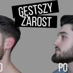 Gęsty zarost na twarzy? Skuteczne metody i porady eksperta!