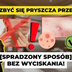 Szybko pozbądź się pryszcza sprawdzone metody na jedną noc!