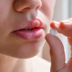 Pryszcz na już? Jak szybko pozbyć się i zapobiec nawrotom