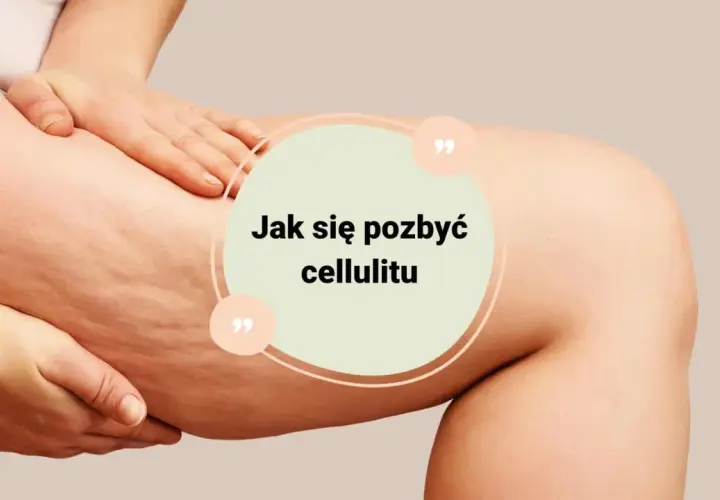 Jak usunąć cellulit? Skuteczny plan: dieta, zabiegi, pielęgnacja