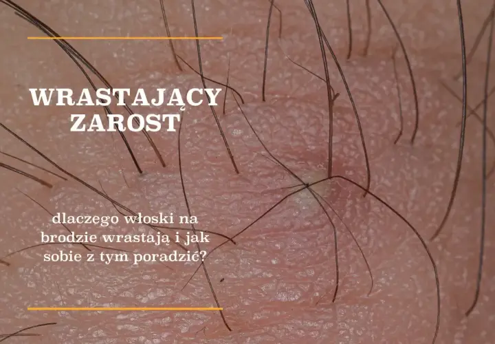 Gęstnienie zarostu: Wiek, geny, hormony co musisz wiedzieć?