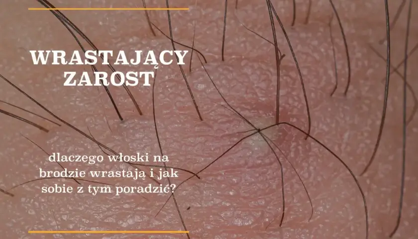 Gęstnienie zarostu: Wiek, geny, hormony co musisz wiedzieć?