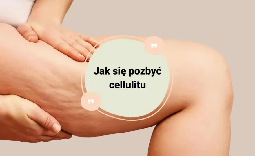 Jak usunąć cellulit? Skuteczny plan: dieta, zabiegi, pielęgnacja
