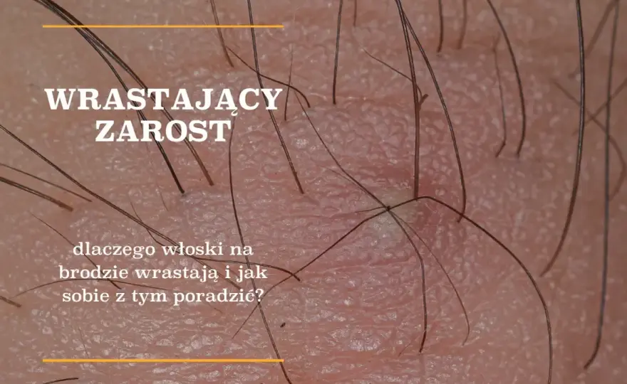 Gęstnienie zarostu: Wiek, geny, hormony co musisz wiedzieć?