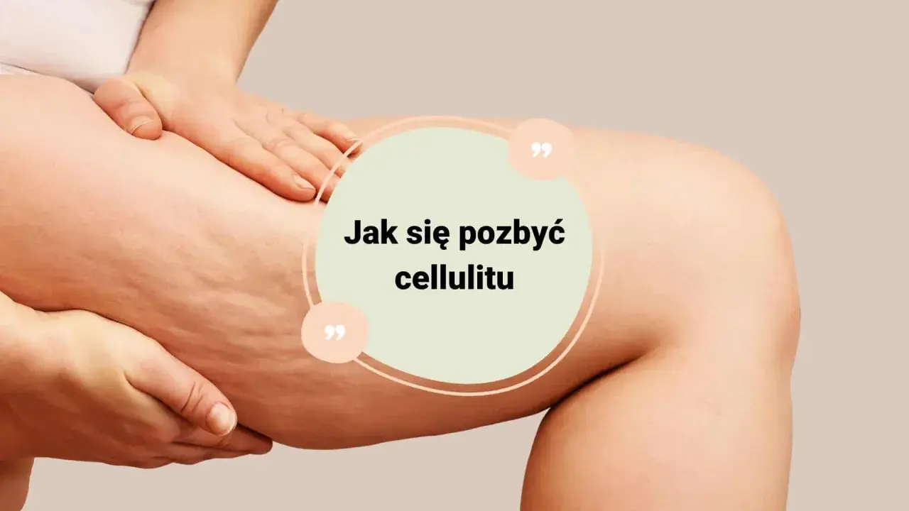 Jak usunąć cellulit? Skuteczny plan: dieta, zabiegi, pielęgnacja