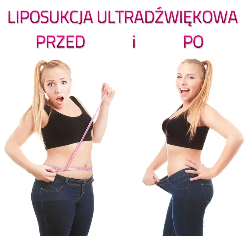 przeciwwskazania do liposukcji infografika